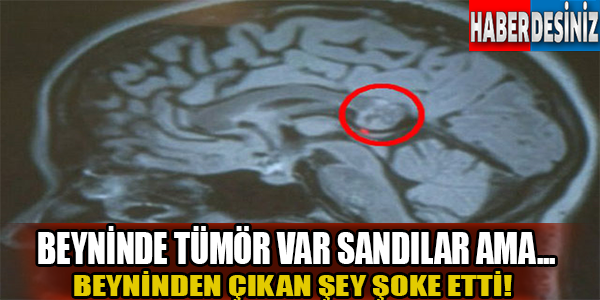 Beyninde tümör var sandılar ama...